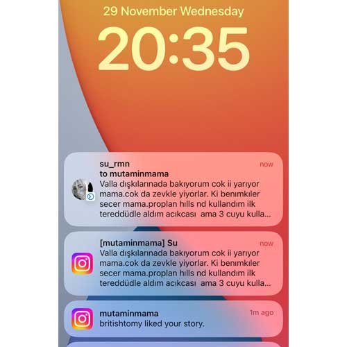 Valla Dışkılarınada Bakıyorum Çok İyi Yarıyor Çokta Zevkle Yiyorlar Ki Benimkiler Mama Seçer